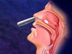 肥厚性鼻炎对身体的影响