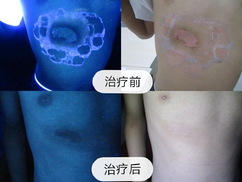 武汉环亚白癜风医院:北京高级医生公益门诊暨白癜风公益大筛查 3.jpg